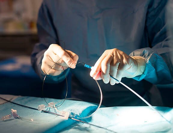 ASD/VSD Closure